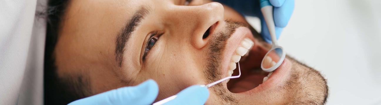 Root Canal Treatment